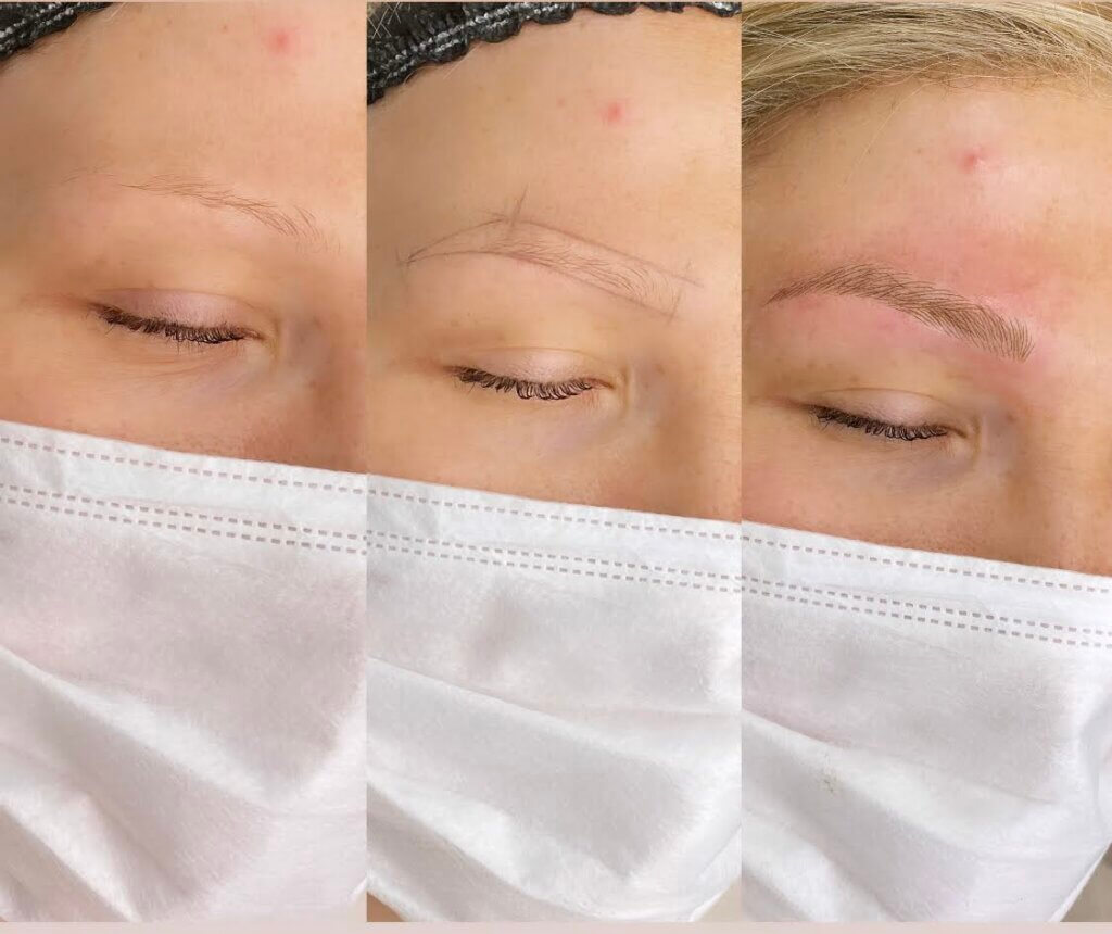 Microblading nach Chemotherapie