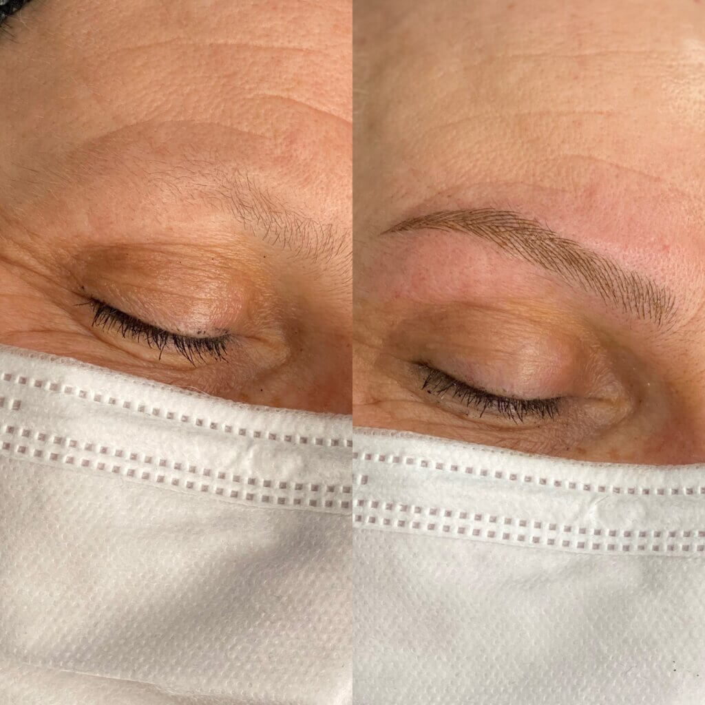 Microblading nach Chemotherapie